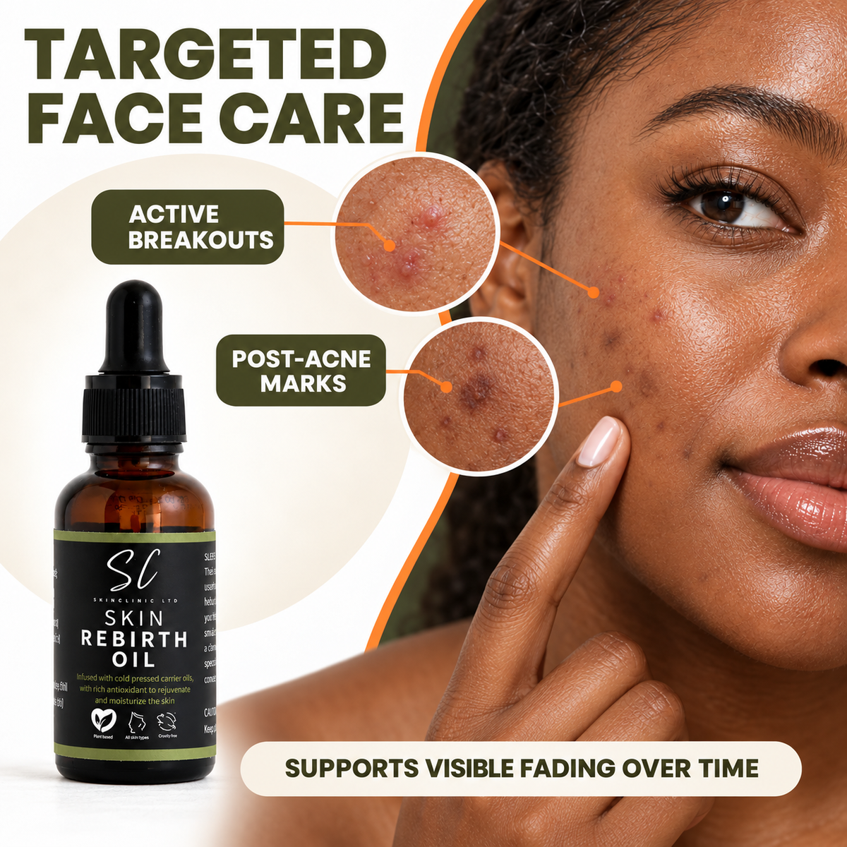 ACNE &amp; LITTEKENS STUK ZEEP