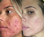 Skin Clinic targeted skincare for real skin concerns