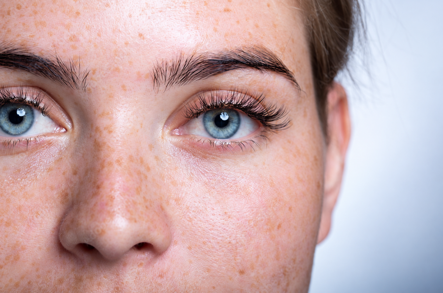 Eyelash Growth